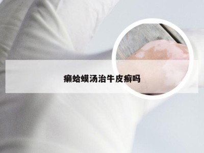 癞蛤蟆汤治牛皮癣吗