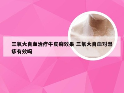 三氧大自血治疗牛皮癣效果 三氧大自血对湿疹有效吗