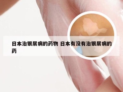 日本治银屑病的药物 日本有没有治银屑病的药