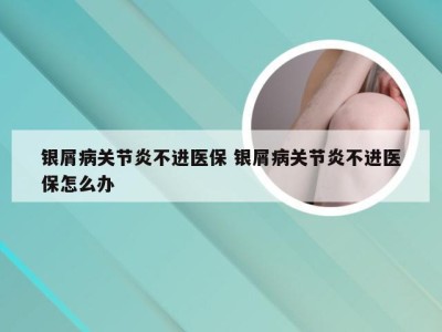 银屑病关节炎不进医保 银屑病关节炎不进医保怎么办