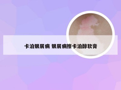 卡泊银屑病 银屑病擦卡泊醇软膏