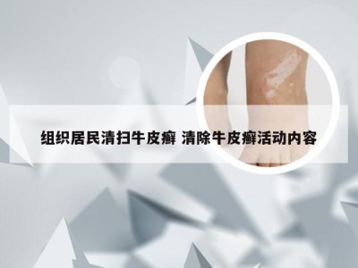 组织居民清扫牛皮癣 清除牛皮癣活动内容