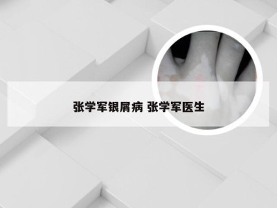 张学军银屑病 张学军医生