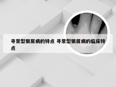 寻常型银屑病的特点 寻常型银屑病的临床特点