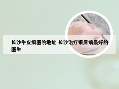 长沙牛皮癣医院地址 长沙治疗银屑病最好的医生
