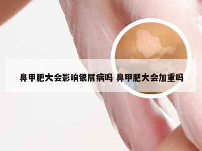 鼻甲肥大会影响银屑病吗 鼻甲肥大会加重吗