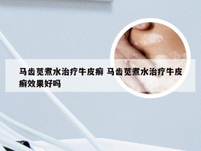马齿苋煮水治疗牛皮癣 马齿苋煮水治疗牛皮癣效果好吗