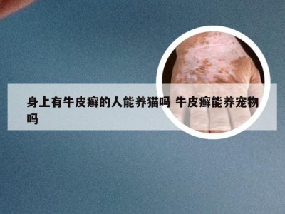 身上有牛皮癣的人能养猫吗 牛皮癣能养宠物吗