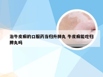 治牛皮癣的口服药当归升肺丸 牛皮癣能吃归脾丸吗