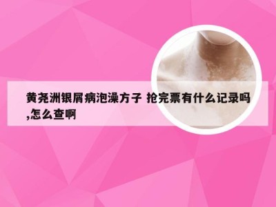 黄尧洲银屑病泡澡方子 抢完票有什么记录吗,怎么查啊