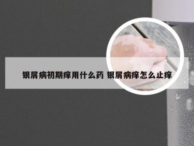 银屑病初期痒用什么药 银屑病痒怎么止痒