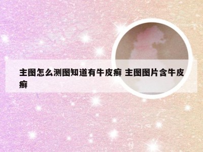 主图怎么测图知道有牛皮癣 主图图片含牛皮癣