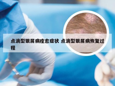 点滴型银屑病痊愈症状 点滴型银屑病恢复过程