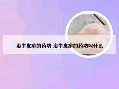 治牛皮癣的药坊 治牛皮癣的药坊叫什么