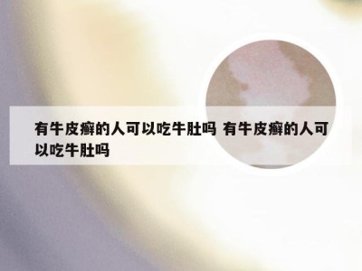 有牛皮癣的人可以吃牛肚吗 有牛皮癣的人可以吃牛肚吗
