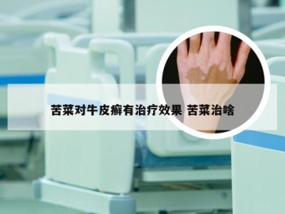苦菜对牛皮癣有治疗效果 苦菜治啥
