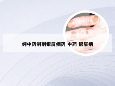 纯中药制剂银屑病药 中药 银屑病
