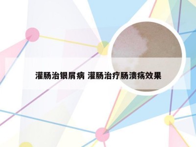 灌肠治银屑病 灌肠治疗肠溃疡效果