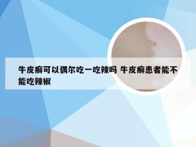牛皮癣可以偶尔吃一吃辣吗 牛皮癣患者能不能吃辣椒