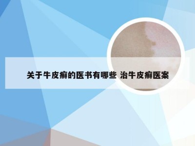 关于牛皮癣的医书有哪些 治牛皮癣医案