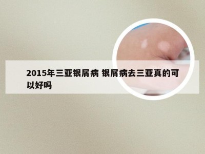 2015年三亚银屑病 银屑病去三亚真的可以好吗