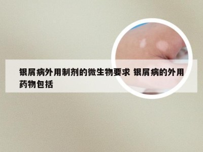 银屑病外用制剂的微生物要求 银屑病的外用药物包括