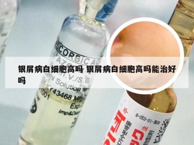 银屑病白细胞高吗 银屑病白细胞高吗能治好吗