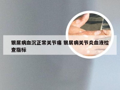 银屑病血沉正常关节痛 银屑病关节炎血液检查指标