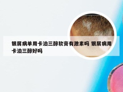 银屑病单用卡泊三醇软膏有激素吗 银屑病用卡泊三醇好吗