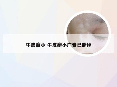 牛皮癣小 牛皮癣小广告已撕掉