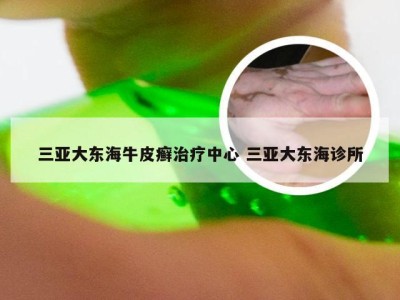 三亚大东海牛皮癣治疗中心 三亚大东海诊所