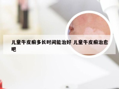 儿童牛皮癣多长时间能治好 儿童牛皮癣治愈吧