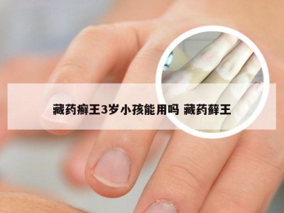 藏药癣王3岁小孩能用吗 藏药藓王