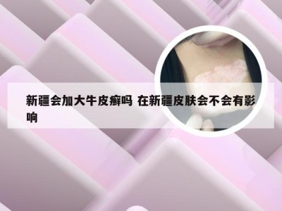新疆会加大牛皮癣吗 在新疆皮肤会不会有影响