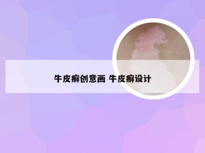 牛皮癣创意画 牛皮癣设计