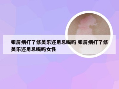 银屑病打了修美乐还用忌嘴吗 银屑病打了修美乐还用忌嘴吗女性