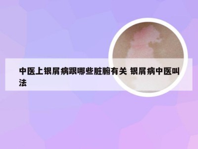 中医上银屑病跟哪些脏腑有关 银屑病中医叫法