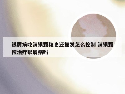 银屑病吃消银颗粒也还复发怎么控制 消银颗粒治疗银屑病吗