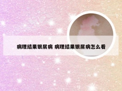 病理结果银屑病 病理结果银屑病怎么看