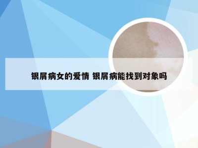 银屑病女的爱情 银屑病能找到对象吗