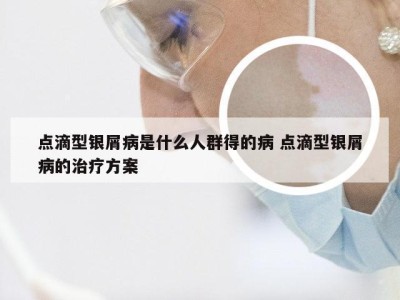 点滴型银屑病是什么人群得的病 点滴型银屑病的治疗方案