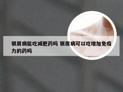 银屑病能吃减肥药吗 银屑病可以吃增加免疫力的药吗