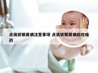 点滴状银屑病注意事项 点滴状银屑病应吃啥药