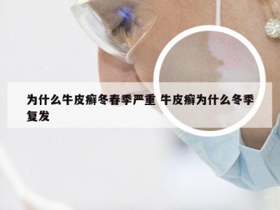 为什么牛皮癣冬春季严重 牛皮癣为什么冬季复发