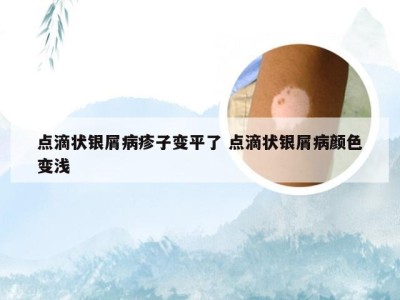 点滴状银屑病疹子变平了 点滴状银屑病颜色变浅