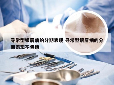 寻常型银屑病的分期表现 寻常型银屑病的分期表现不包括