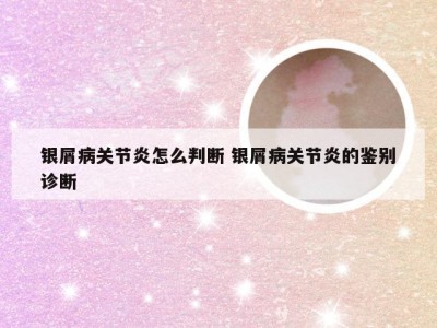 银屑病关节炎怎么判断 银屑病关节炎的鉴别诊断