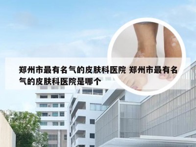 郑州市最有名气的皮肤科医院 郑州市最有名气的皮肤科医院是哪个