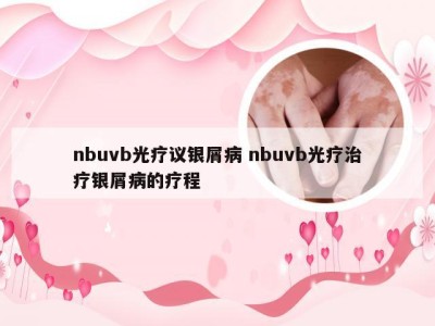 nbuvb光疗议银屑病 nbuvb光疗治疗银屑病的疗程