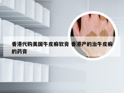 香港代购美国牛皮癣软膏 香港产的治牛皮癣的药膏